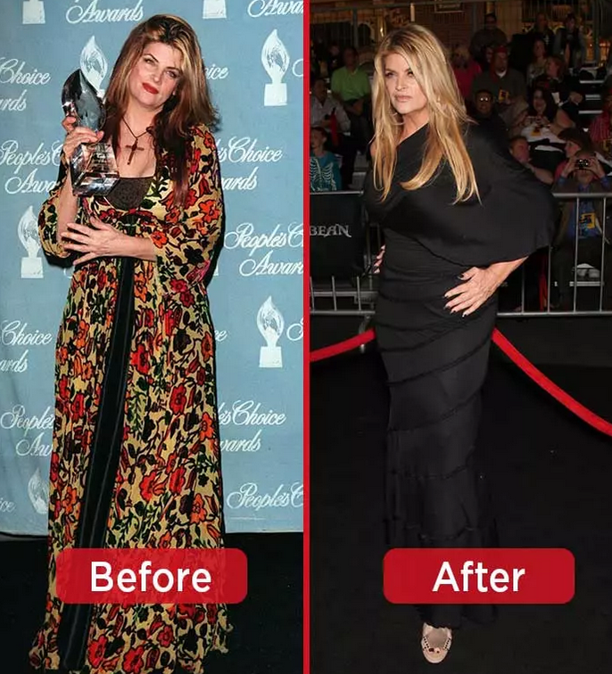 Kirstie Alley's Weight Loss journey