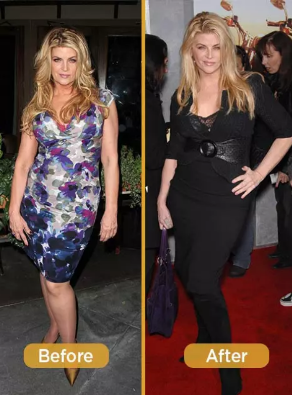 (Kirstie Alley's Weight Loss journey)